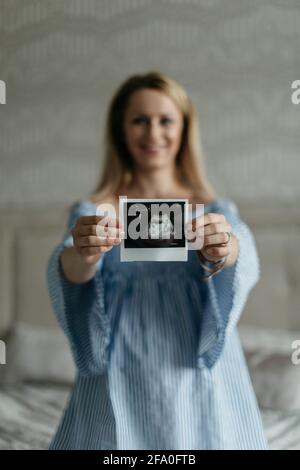 A portrait of a happy pregnant woman showing an ultrasound picture of her unborn baby into a camera. A cheerful expectant woman with a sonogram. Stock Photo