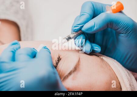 Miliums on the face, removal of hardened and mature milia by a beautician. new Stock Photo