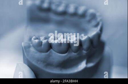 The lower jaw of a man, created on a 3d printer from a photopolymer material Stock Photo