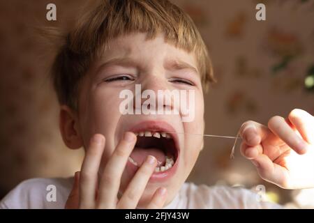 Portrait of boy upset by crying. Close-up of frustrated kid is sad and painful to remove baby teeth, screaming in pain. Stock Photo