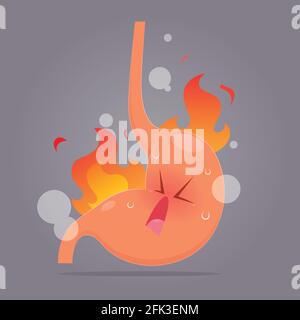Illustration from acid reflux or heartburn, Cartoon vector, Concept with internal health Stock Vector