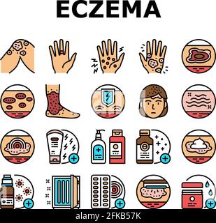 Eczema Disease Treat Collection Icons Set Vector Stock Vector Image ...