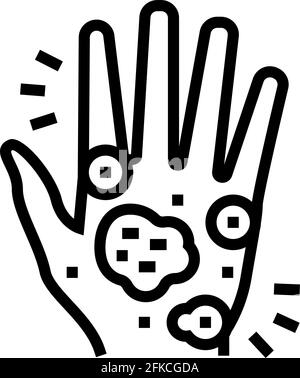 hand eczema line icon vector illustration Stock Vector