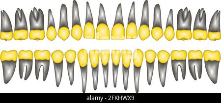 3D gold crown tooth Stock Vector