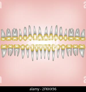 gold tooth Stock Vector