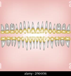 gold tooth Stock Vector
