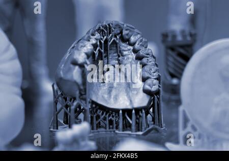 The lower jaw of a man, created on a 3d printer from a photopolymer material Stock Photo