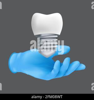 Dentist hand wearing blue protective surgical glove holding a ceramic model of the tooth. 3d realistic vector illustration of dental implants concept Stock Vector