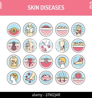 Skin diseases line icons set. Isolated vector element. Outline pictograms for web page, mobile app, promo. Editable stroke. Stock Vector