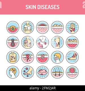 Skin diseases line icons set. Isolated vector element. Outline ...
