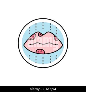 Herpes color line icon. Dermatology disease. Isolated vector element. Outline pictogram for web page, mobile app, promo Stock Vector