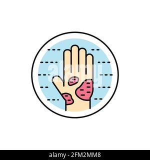 Eczema color line icon. Dermatology disease. Isolated vector element. Outline pictogram for web page, mobile app, promo Stock Vector