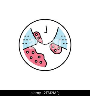 Psoriasis color line icon. Dermatology disease. Isolated vector element. Outline pictogram for web page, mobile app, promo Stock Vector