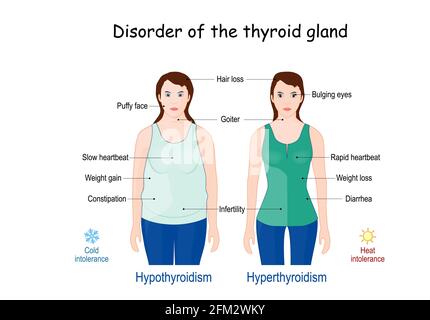 thyroid gland disorder. comparison and difference between Hyperthyroidism and Hypothyroidism. Signs and symptoms Stock Vector