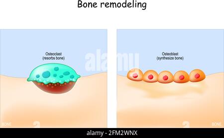 Bone Remodeling Process (resorption, Reversal, Formation, And ...