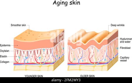 Aging skin. comparison and difference between older and younger skin. Close-up of fibroblast, collagen, elastin, and Oxytalan fibers, Hyaluronic acid. Stock Vector