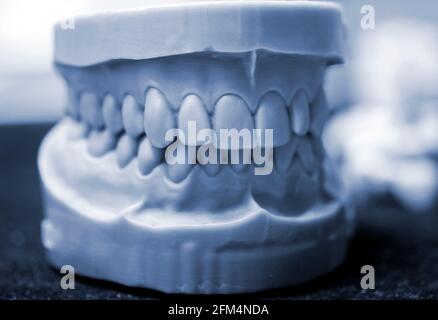 Upper and lower jaw of a man printed on a 3d printer of photopolymer. Stock Photo