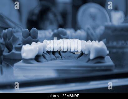 The lower jaw of a man, created on a 3d printer from a photopolymer material Stock Photo