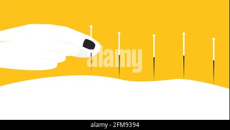 Person receiving acupuncture treatment from practitioner. Illustration of a practitioner using needle upon skin Stock Vector