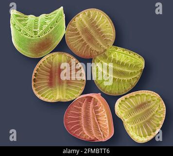 Diatoms, SEM Stock Photo