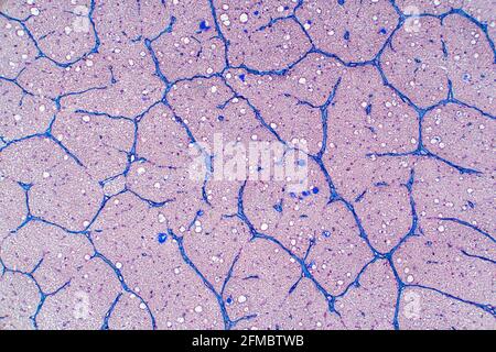 Human optic nerve, light micrograph Stock Photo
