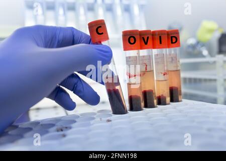 Close up of biologist's hand holding test tube with blood sample, with erythrocyte deposition. Coronavirus testing concept Stock Photo