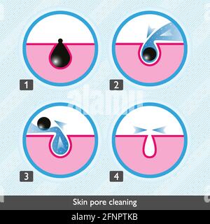 Skin pore cleansing process icons. Facial treatments colored icons. Treatment of skin diseases, sebum removal and pores cleaning and narrowing. Medica Stock Vector