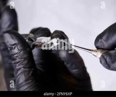 Macro shooting of orthodontic ceramic bracket in dentist's hands wearing black latex gloves. Process of putting adhesive paste on bracket before installation. Orthodontic treatment concept Stock Photo