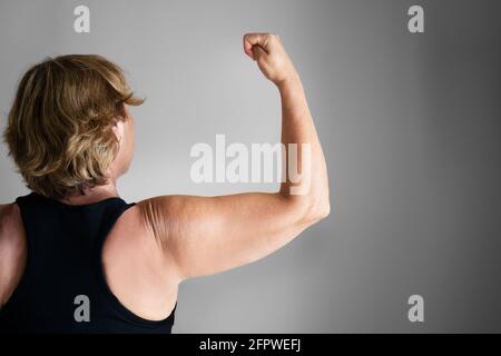 Overweight Lady Arm With Excess Fat. People Obesity Stock Photo