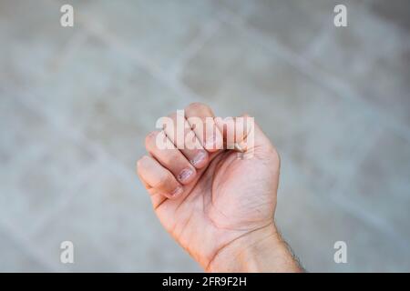 A man's hand with bitten and ugly fingernails. Bad care of hands Stock ...