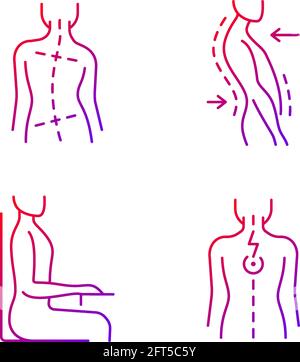 Bad posture problems gradient linear vector icons set. Uneven hips and shoulders. Swayback posture. Muscle spasms. Thin line contour symbols bundle. I Stock Vector