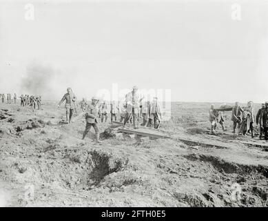 Wounded British soldiers, Western Front, WW1 Stock Photo - Alamy