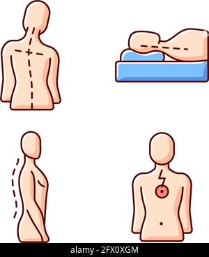 Postural dysfunction RGB color icons set Stock Vector