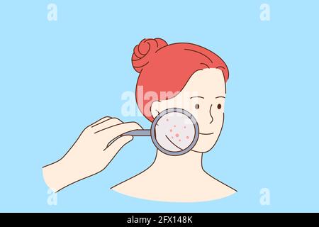 Skin problems and beauty concept. Face of young smiling pretty red haired woman cartoon character with magnifying glass and red pimples on skin vector illustration  Stock Vector