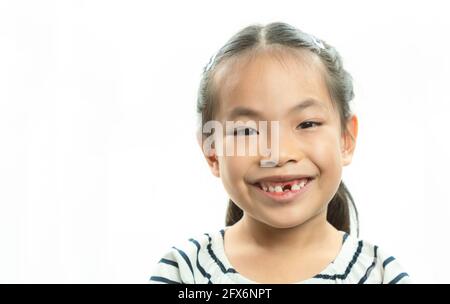 Adorable Asian little girl smiling and showing off her first lost milk tooth. Cute portrait Asian little girl after dropping her front milk tooth, fre Stock Photo