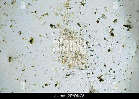 A lot of ciliates under the light microscope Stock Photo