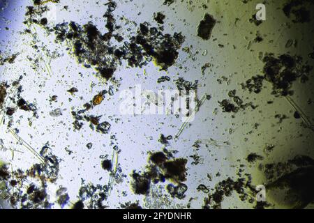 Stylonichia mytilus and microalgae under the light microscope Stock Photo