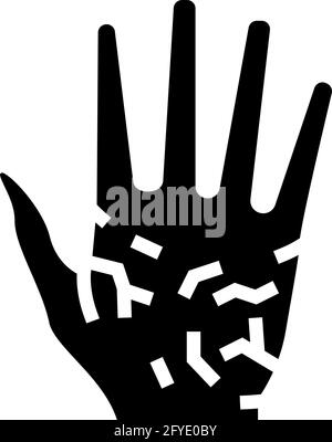 palms dry skin glyph icon vector illustration Stock Vector