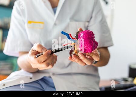 3D printed kidney model with tumor, 3D printing improves the preparation of the surgeon who thus visualizes the complexity of the case, It also allows Stock Photo