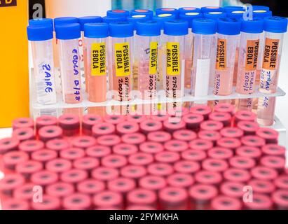 Blood sample from Ebola patient, positive result, conceptual image Stock Photo