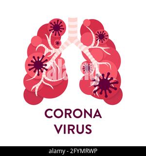 Coronavirus particles in lungs, conceptual illustration Stock Photo