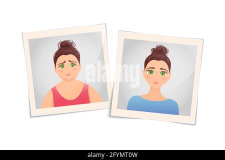 Weight loss, conceptual illustration Stock Photo