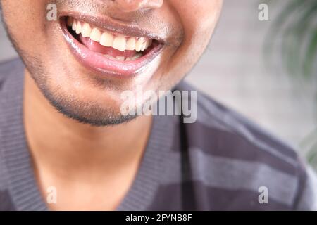 young man open mount checking his teeth  Stock Photo