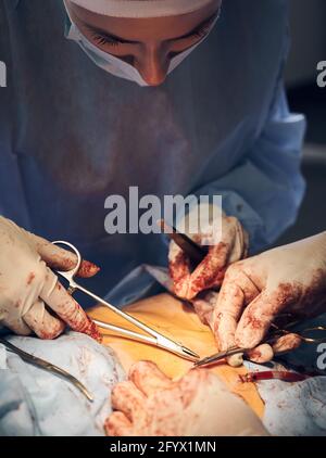 Close up of medical workers hands in sterile gloves stitching up wound after plastical surgical operation. Surgeon placing sutures after abdominal plastic surgery, assistant using medical instruments Stock Photo