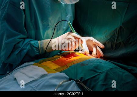 Suture of an lung emphysema surgery in an infant, medical assistance close-up Stock Photo