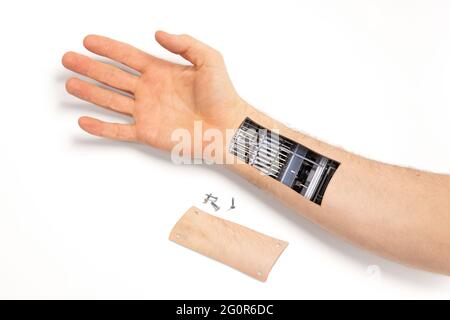 Robot hand inside human hand - Prosthesis concept, isolated on white Stock Photo