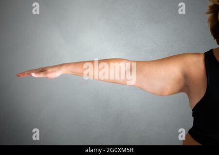 Overweight Lady Arm With Excess Fat. People Obesity Stock Photo