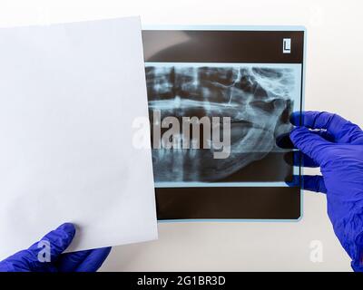 Dentist hands take the panoramic facial x-ray image out of the paper envelope. Original x-ray teeth scan of an old person. Dental prosthetics. Closeup Stock Photo