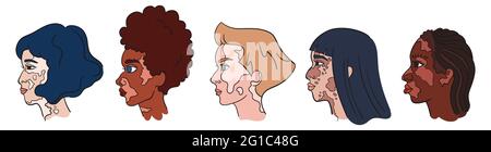 World Vitiligo Day. Women faces with pigment spots. Isolated portraits - vector vitiligo set Stock Vector