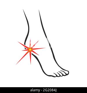 Leg with heel pain. Orthopedic disease plantar fasciitis. Vector isolated outline illustration Stock Vector